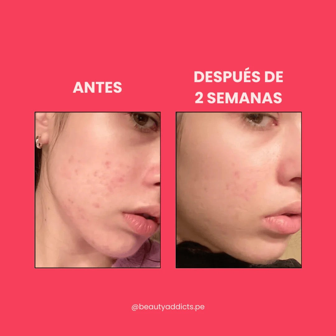 Serum Facial Niacinamide 10% + Txa 4% 30ml Anua